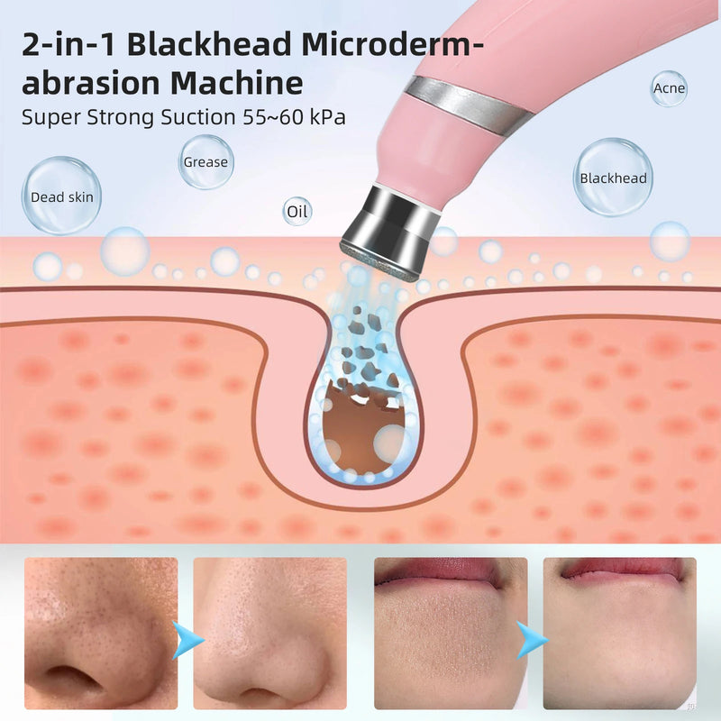Microdermabrasion Machine Facial Peeling Device