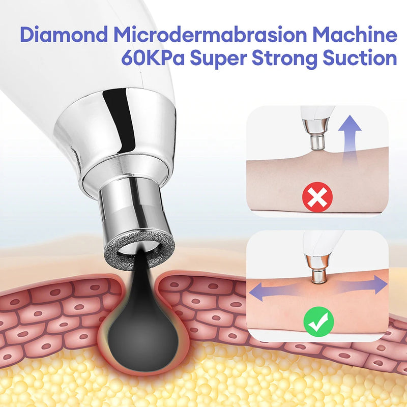 Handhold Diamond Microdermabrasion Machine