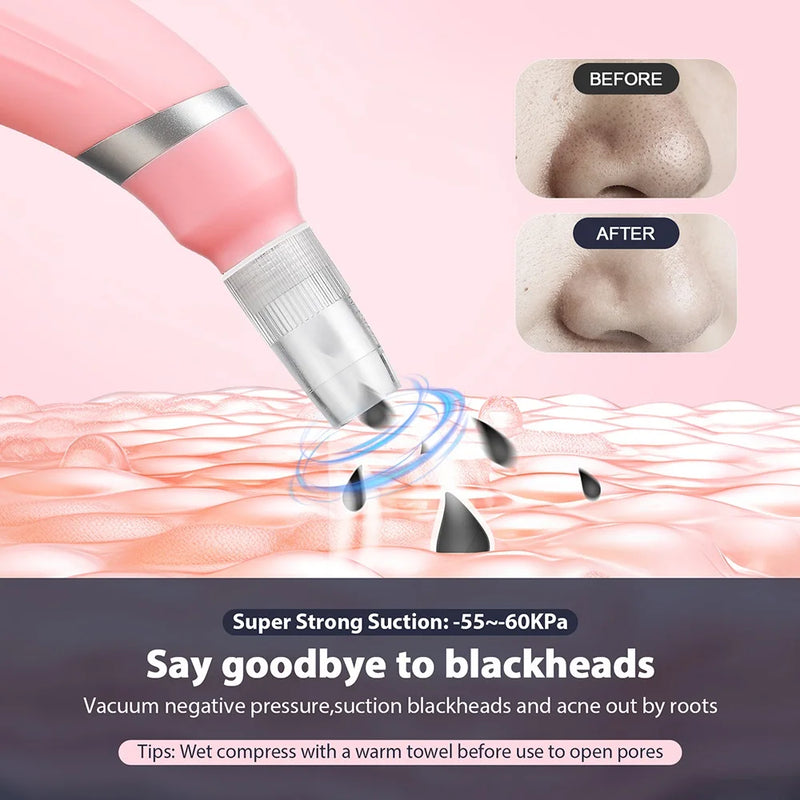 Microdermabrasion Machine Facial Peeling Device