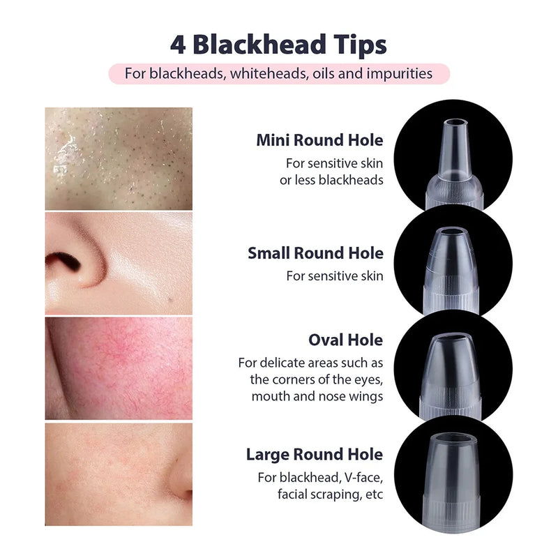 Microdermabrasion Machine Facial Peeling Device