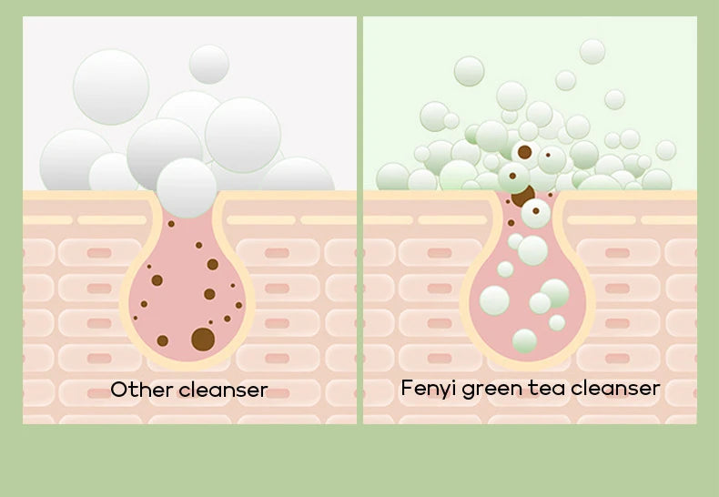 Deep Cleansing Moisturizing Blackhead Removal