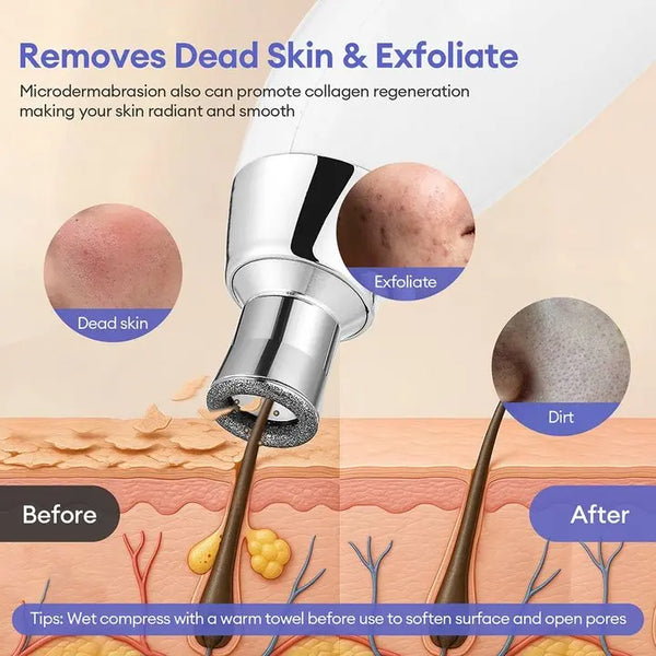 Handhold Diamond Microdermabrasion Machine