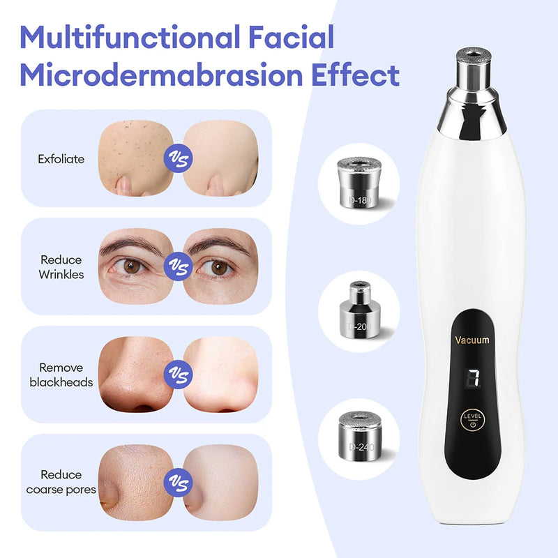 Handhold Diamond Microdermabrasion Machine