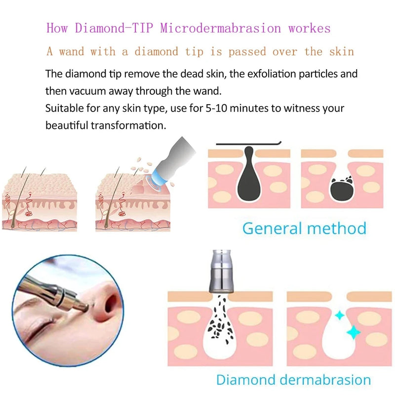 Facial Diamond Dermabrasion Machine Portable Blackhead
