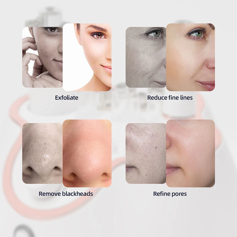 Foreverlily Diamond Facial Peeling Machine Home