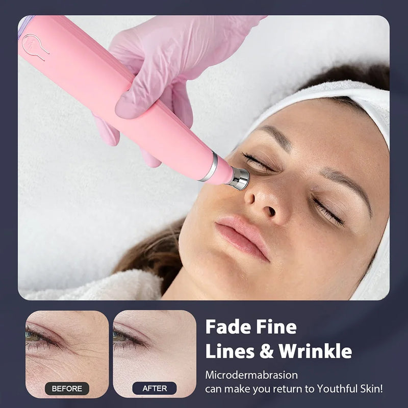 Microdermabrasion Machine Facial Peeling Device