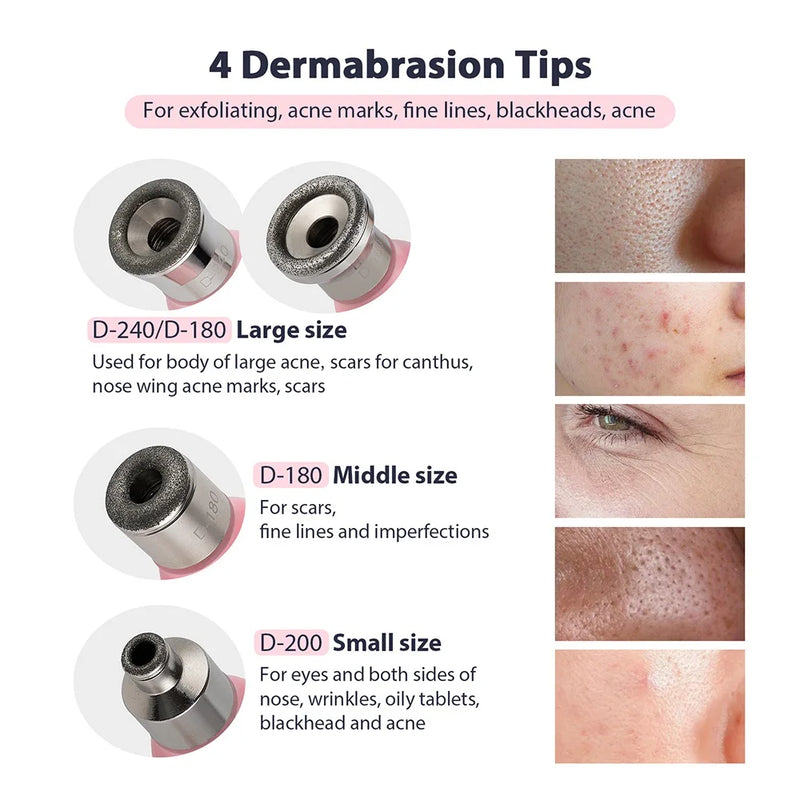 Microdermabrasion Machine Facial Peeling Device